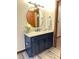 Bathroom featuring a granite countertop vanity and framed round mirror in a well-lit space at 1449 Albans Ct, Lithonia, GA 30058