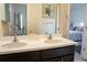 Bathroom featuring double sinks, modern fixtures, and a vanity with dark wood cabinetry at 4125 Hidden River Dr, Cumming, GA 30028