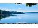 Expansive lake view showcasing the calm blue waters and the lush greenery surrounding the homes at 222 Mossy Pl, Alpharetta, GA 30005