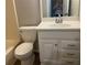 Bathroom featuring a white toilet and vanity with a modern sink and stylish faucet at 486 Victoria Rd, Woodstock, GA 30189