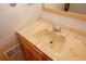 Close-up of bathroom sink with wooden cabinet and unique faux marble top at 3257 Georgian Woods Cir, Decatur, GA 30034