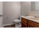 Simple bathroom featuring a toilet, sink, and wooden vanity at 847 Ashley Ln, Stone Mountain, GA 30087