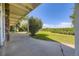 Covered patio overlooking a green lawn and distant trees at 34 S Raleigh St, Denver, CO 80219