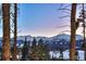 Stunning mountain view from the property at 699 Highlands Dr, Breckenridge, CO 80424