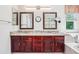 Beautiful main bathroom featuring double sinks, granite countertops, and dark wood cabinets at 775 Poppywood Dr, Highlands Ranch, CO 80126