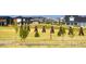 Large, green community field with homes in the background at 5983 Fulton St, Denver, CO 80238