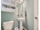 Cozy powder room featuring a pedestal sink, wall cabinet, and neutral color palette at 2508 Coach House Loop, Castle Rock, CO 80109