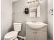 Updated half bathroom with a modern vanity, new sink, toilet, and paper towel dispenser at 16623 E Asbury Pl, Aurora, CO 80013