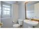 Cozy half bathroom featuring a pedestal sink, toilet and window at 3355 Willowrun Dr, Castle Rock, CO 80109
