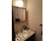 Bathroom with vanity, sink, and medicine cabinet at 2218 Coronado N Pkwy # B, Denver, CO 80229