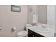 Well-lit powder room with neutral walls, framed art, and a white sink vanity featuring dark wood cabinetry at 436 Sage Grouse Cir, Castle Rock, CO 80109