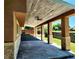 The covered patio features wood plank ceilings, stone pillars, recessed lighting, and concrete at 16800 E Bails Pl, Aurora, CO 80017