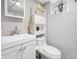 Bright bathroom with a modern white vanity, a toilet, and storage shelves at 2995 Albion St, Denver, CO 80207