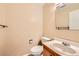 This half bathroom offers a classic white sink and toilet at 3532 Morning Glory Dr, Castle Rock, CO 80109