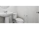 Clean powder room featuring a pedestal sink and white toilet at 6794 Merseyside Ln, Castle Pines, CO 80108
