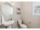 Powder room featuring a pedestal sink, toilet, framed art, and a window with blinds at 16075 E 109Th Pl, Commerce City, CO 80022