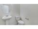 Clean and simple half-bathroom with pedestal sink, white toilet, and minimalist design at 4757 Windmill Dr, Brighton, CO 80601