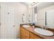 Bathroom with double sinks, wood cabinets, and a decorative window for added privacy at 3542 W 125Th Dr, Broomfield, CO 80020