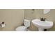 Powder room featuring a pedestal sink, toilet, and bronze fixtures at 4714 Carmichael Ct, Brighton, CO 80603