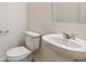 Bright half bathroom featuring a pedestal sink and toilet with neutral colors, creating a clean look at 760 N Deer Park St, Watkins, CO 80137