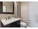 Bathroom with marble vanity, dark brown cabinets, and a toilet at 8939 Devinney Ct, Arvada, CO 80005