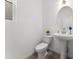 Stylish half bathroom with a pedestal sink, toilet, and a modern aesthetic at 8480 Arriba Dr, Littleton, CO 80125