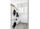 Bright laundry room with a stacked washer and dryer, cabinets, and ample counter space at 140 Race St, Denver, CO 80206
