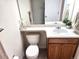 Cozy bathroom featuring a toilet, vanity with sink, and a mirror reflecting the tub at 3747 Windriver Trl, Castle Rock, CO 80109