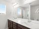 Beautifully lit bathroom with double vanity, dark wood cabinets, and a serene atmosphere at 17424 E 90Th Pl, Commerce City, CO 80022