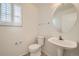 Cozy powder room featuring a pedestal sink, toilet and a shuttered window at 5423 Ben Park Cir, Parker, CO 80134