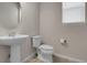 Clean powder room featuring a pedestal sink, modern toilet, and natural light at 23895 E Rocky Top Pl, Aurora, CO 80016