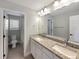 Well-lit bathroom with a double vanity, granite countertops, and modern fixtures at 11650 Lewiston Ct, Commerce City, CO 80022