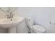 Cozy half-bathroom with a pedestal sink and a toilet at 2128 S Haleyville Way, Aurora, CO 80018
