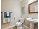 Cozy bathroom featuring a pedestal sink, toilet, and neutral wall color with tasteful artwork for a relaxing space at 3309 Springbriar Dr, Castle Rock, CO 80109