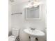 Bathroom features a pedestal sink, toilet, and ornate framed mirror at 6762 E Briarwood Dr, Centennial, CO 80112