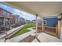Inviting porch overlooking a lush green lawn and a row of colorful neighborhood homes at 10291 E 62Nd Pl, Denver, CO 80238