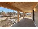 Covered porch featuring a concrete floor, wood ceiling, and wooden columns with a view of the neighborhood at 2828 N Illinois St, Indianapolis, IN 46208