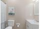 The bathroom features a toilet, sink, towel rack, and a shower with blue patterned shower curtains at 6001-1723 South Kings Hwy., Myrtle Beach, SC 29575