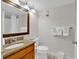 Bathroom featuring a sink, granite countertop, a toilet and shower with tiled floors at 9550 Shore Dr. # 1511, Myrtle Beach, SC 29572