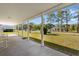 Inviting front porch with white columns, view of the lawn, and rocking chairs at 6593 Sunshine St. Nw, Ocean Isle Beach, NC 28469