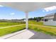 Patio view with scenic lake and playground, offering tranquil outdoor living at 490 Calhoun Falls Dr., Myrtle Beach, SC 29579