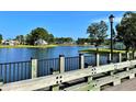 Scenic view of a tranquil pond with houses in the background, captured from a wooden dock with black railings at 419 Starlit Way, Myrtle Beach, SC 29579