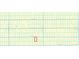 Property map view featuring lot and street names at 9124 Sw 158Th Ln, Dunnellon, FL 34432