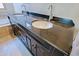 Bathroom featuring a dual vanity with dark wood cabinets and granite countertops at 32960 N 70Th St, Scottsdale, AZ 85266