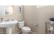 Cozy powder room featuring a pedestal sink, a toilet, and neutral decor with charming accents at 2543 N 73Rd Dr, Phoenix, AZ 85035