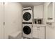Bright laundry room with stacked LG washer and dryer and white cabinets at 10155 E Wood Dr, Scottsdale, AZ 85260