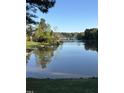 Scenic lake view reflecting the surrounding trees and sky, offering a tranquil and picturesque setting at 406 Southshore Pkwy, Durham, NC 27703
