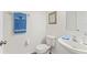 Clean and bright bathroom with white fixtures and blue towels at 14935 Skip Jack Loop # 106, Lakewood Ranch, FL 34202